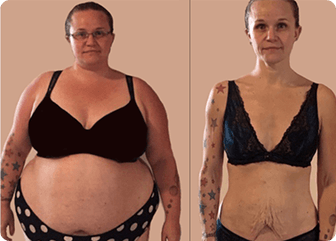 Jessica M – ShapeON customer