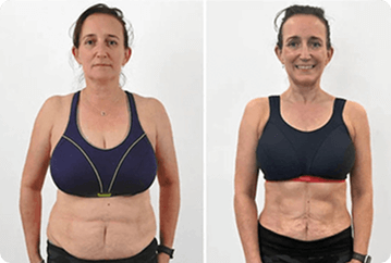 Sarah K – ShapeON customer